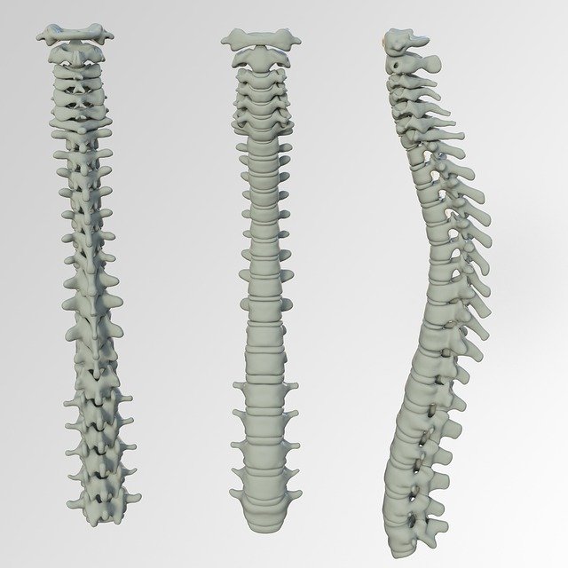 spine, bone, back pain spine, bone, back pain